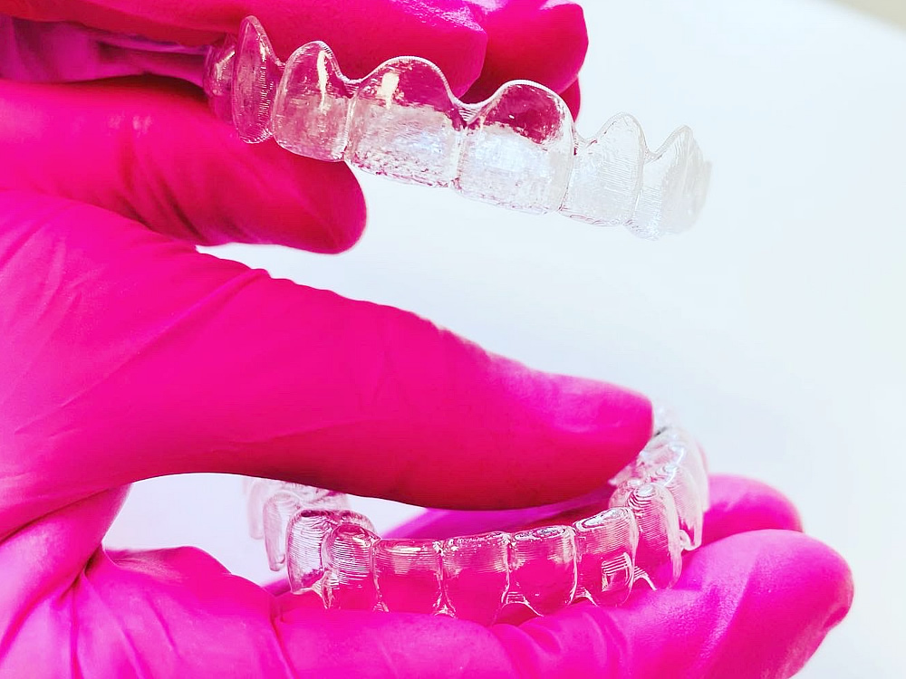 Zahnkorrekturen mit transparenten Invisalign Schienen